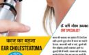 Ear Cholesteatoma Treatment in Ambala | Dr. Rishi Gautam Aggarwal | ENT specialist in Ambala
