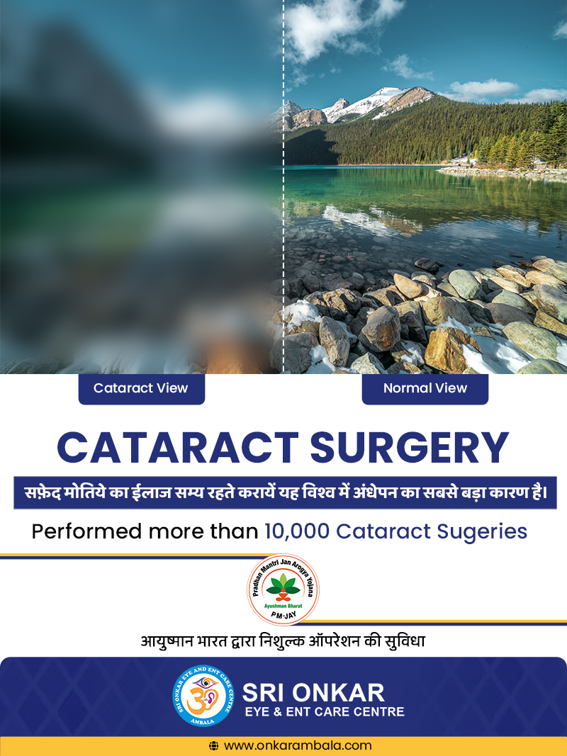 Best Cataract Surgery in Ambala | Dr. Jaspreet Aggarwal | Ophthalmologist
