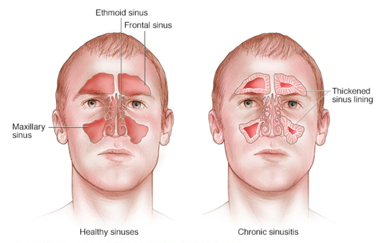 sinus