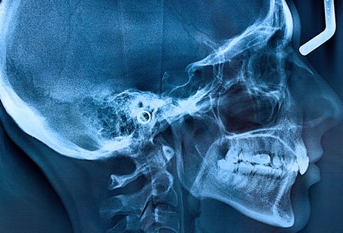 skull-jawbone